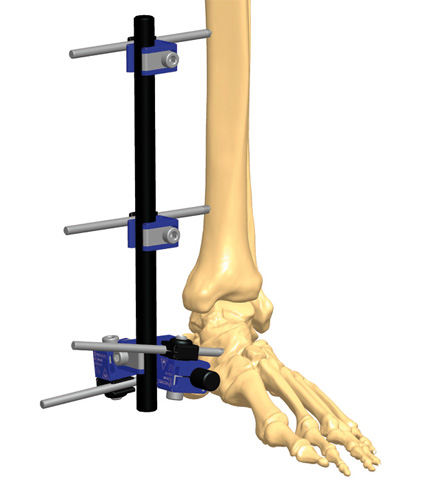 HCLMED - Equipamentos Médicos